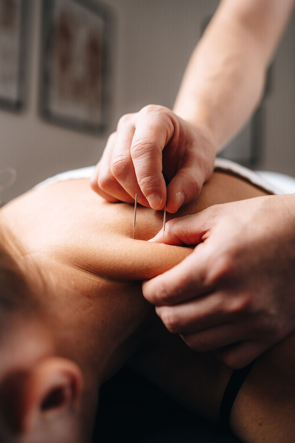 Person som ligger på brits får naprapatisk massage med apparat